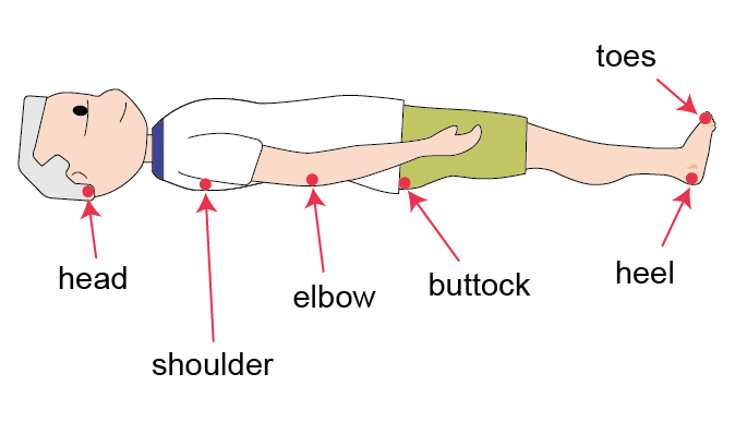 An elderly man in lying position, red arrows pointing to the common sites of pressure injuries: head, shoulder, elbow, buttock, heel and toes An elderly man in lying position, red arrows pointing to the common sites of pressure injuries: head, shoulder, elbow, buttock, heel and toes