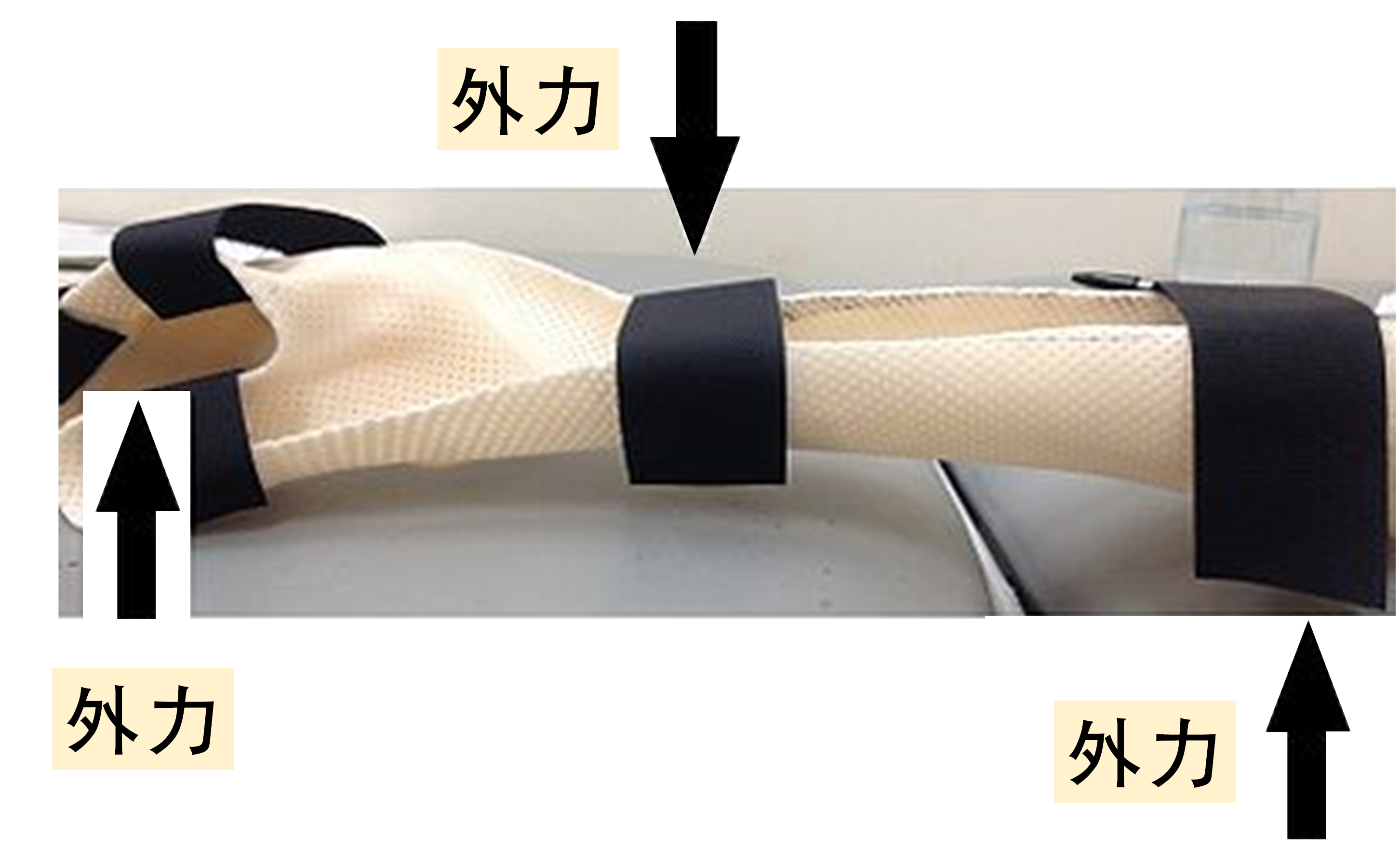 一支右手佩戴的手部固定支架及阐述了「外力牵拉性」的力学原理