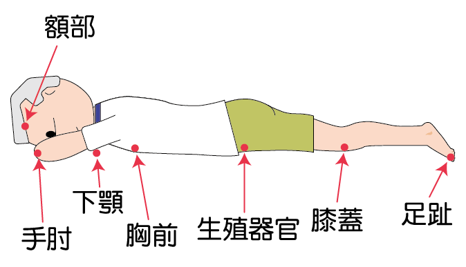一位男長者俯臥，紅色箭咀指著壓力性損傷常見的位置：額部、手肘、下顎、胸前、生殖器官、膝蓋及足趾