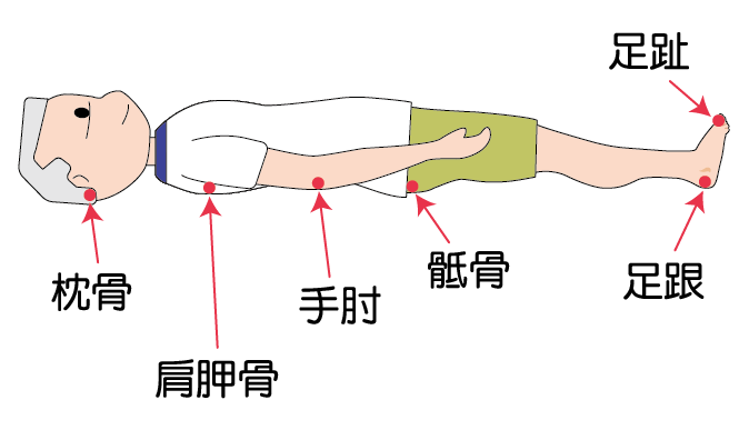 一位男長者仰臥，紅色箭咀指著壓力性損傷常見的位置：枕骨、肩胛骨、手肘、骶骨、足跟及足趾